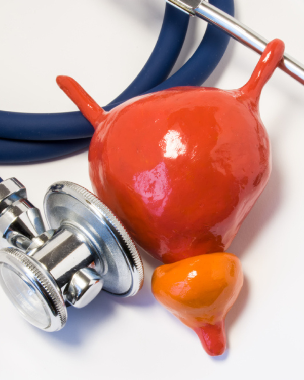 SF-hiperplasia-prostatica