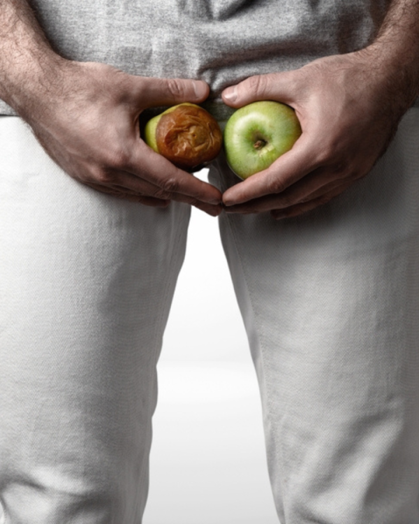 SF-tumores-urologicos